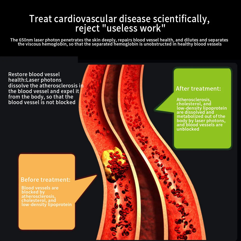 Smart Health 650nm Low Level 13 Laser Therapy Hypertension Diabetic Anti-inflammatory Treatment Physiotherapy Home Use Devices